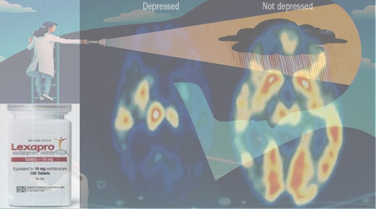 lexapro-dysthymia